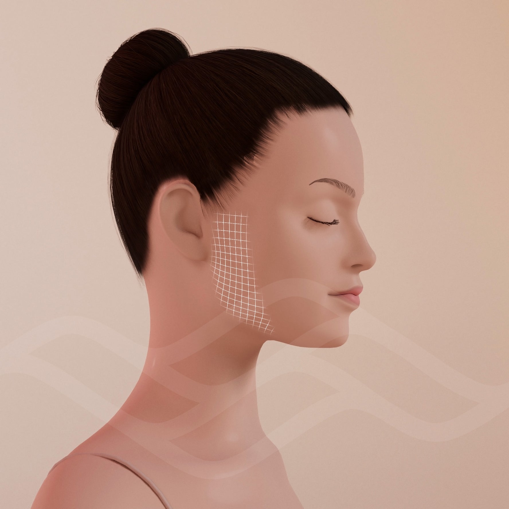 Patillas | Depilación Láser